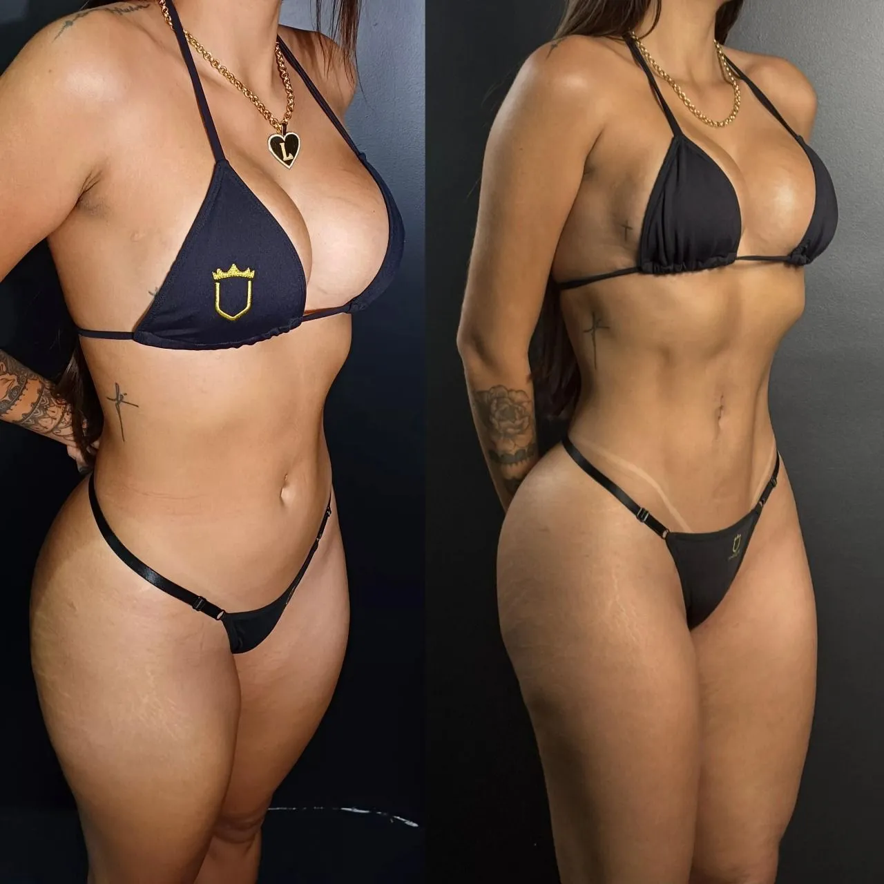 Antes e depois — resultado real