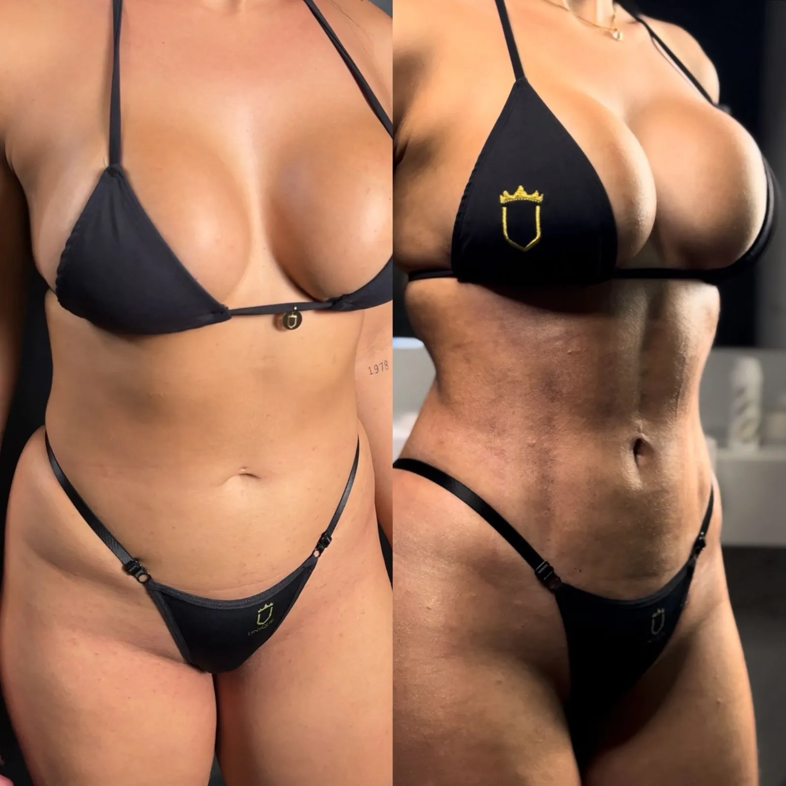 Antes e depois — resultado real