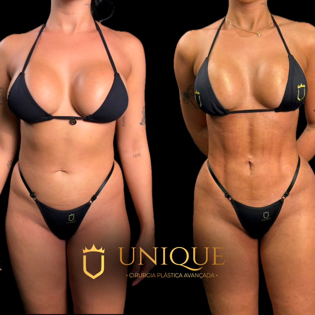 Antes e depois — resultado real